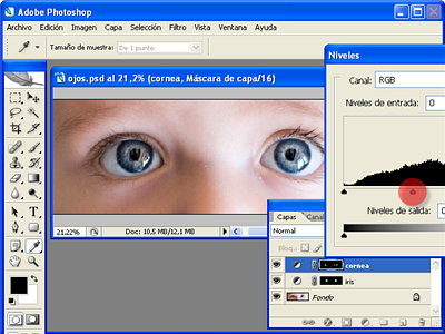 Ajustando los niveles en la cornea