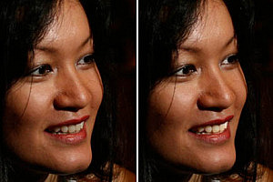 dientes-blancos-resultado